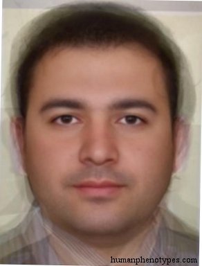 Male representative of East Alpinid